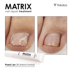 Yokaba Matrix Regeneracja Macierzy Paznokcia 15ml